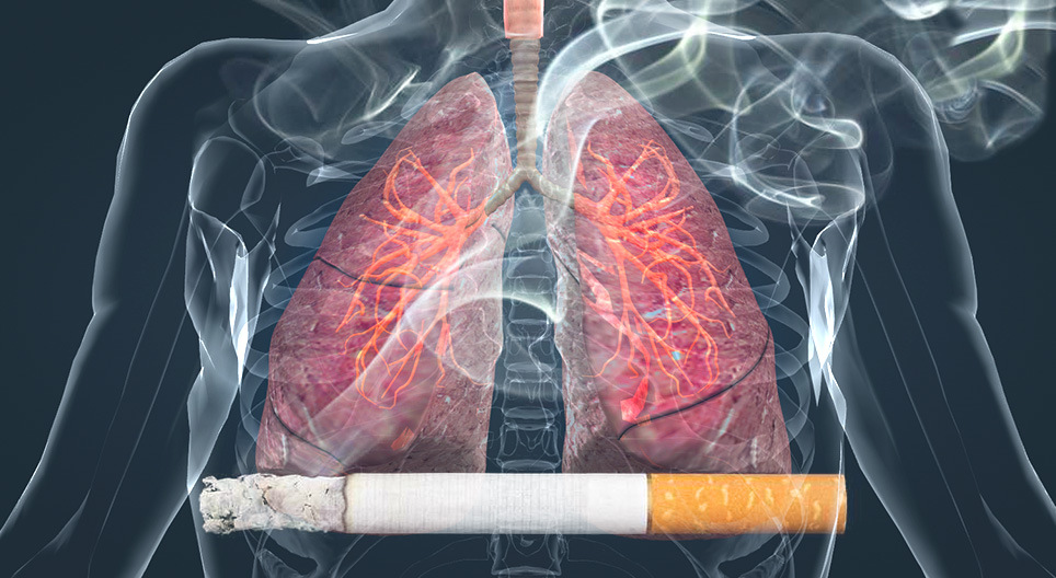 Effects of smoking on the lungs