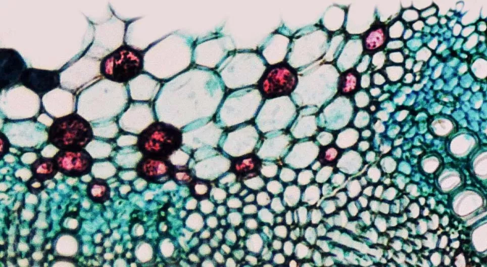 식물의 관다발 조직이 어떻습니까?