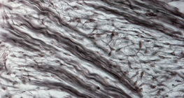 Tkanka włóknisto-chrzęstna (z nosa zarodka świńskiego)