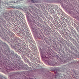 肌腱（横截面）