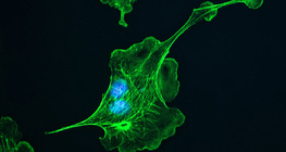 Cytoszkielet (z komórek znajdujących się w płucach bydła domowego)