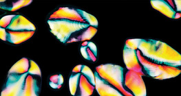 감자의 녹말 입자