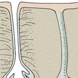 غدد الجلد: غدة دهنية