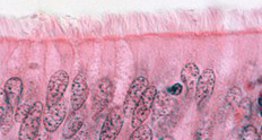 Ciliated columnar epithelium