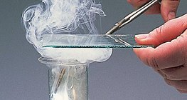 마그네슘과 염소 간의 반응