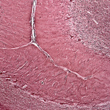 Section of human cerebellum