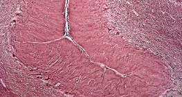 인간 소뇌의 횡단면