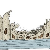 喫煙者の気道の繊毛上皮