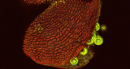 ミラビリス花粉袋、開かれた（共焦点レーザー走査顕微鏡）