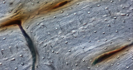 Bone (longitudinal section)