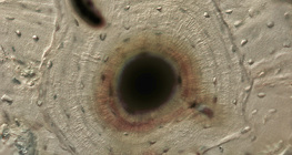Bone (cross section)
