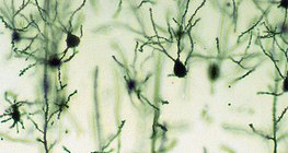 大脑皮层神经元