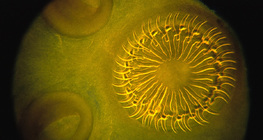 달팽이의 촌충의 기줄기와 빨판