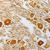 脊神经节上的神经细胞