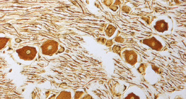 척수 신경절의 신경 세포
