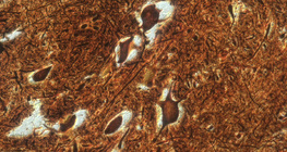 척수 신경절의 신경 세포 (소)