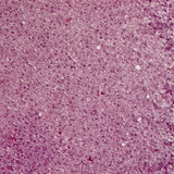 adrenal gland