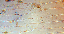 양파의 다육엽의 세포