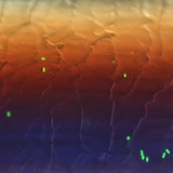 Fluorescent E.coli bacteria on hair