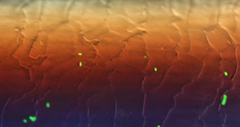 머리가락 위의 형광성의 대장균