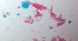 Patogen gruźlicy, Mycobacterium tuberculosis