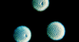 Sponge spicules (gąbki spikule) - kuliste (Geodia cydonium)