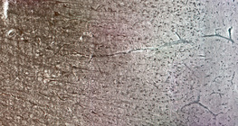 인간 대뇌 피질과 그의 다양한 세포층