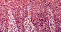 Przekrój poprzeczny języka ludzkiego