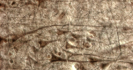 인간 대뇌 피질과 거대추체세포