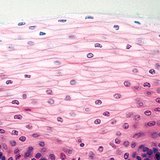 非角質層状扁平上皮