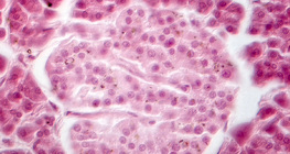 췌장 (위상 대비 이미지) - 랑게르한스섬의 세포들은 더 연해요