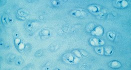 Cartilage tissue