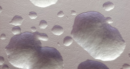 大腸菌細菌コロニー（無染色、白色）