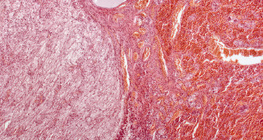 뇌하수체 (종단면, 최저 배율)
