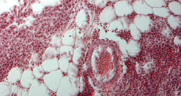 Odcinek ludzkiego płuca