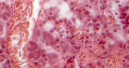 뇌하수체의 일부