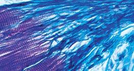 Connection between muscle and tendon