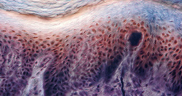 受容体を有するヒトの指の皮膚の断面