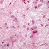 Wycinek przysadki mózgowej