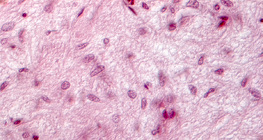 뇌하수체의 일부