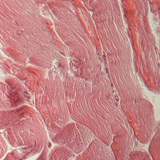 Tkanka ścięgna (przekrój poprzeczny)