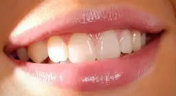 Cosa sappiamo riguardo ai denti?