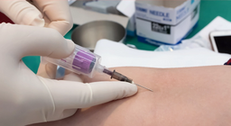 Phlebotomy