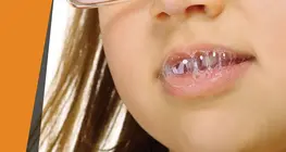 Saliva "corrosiva"