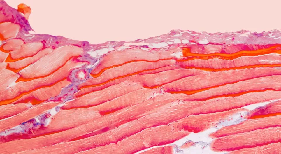 Z jakich tkanek składają się nasze mięśnie?