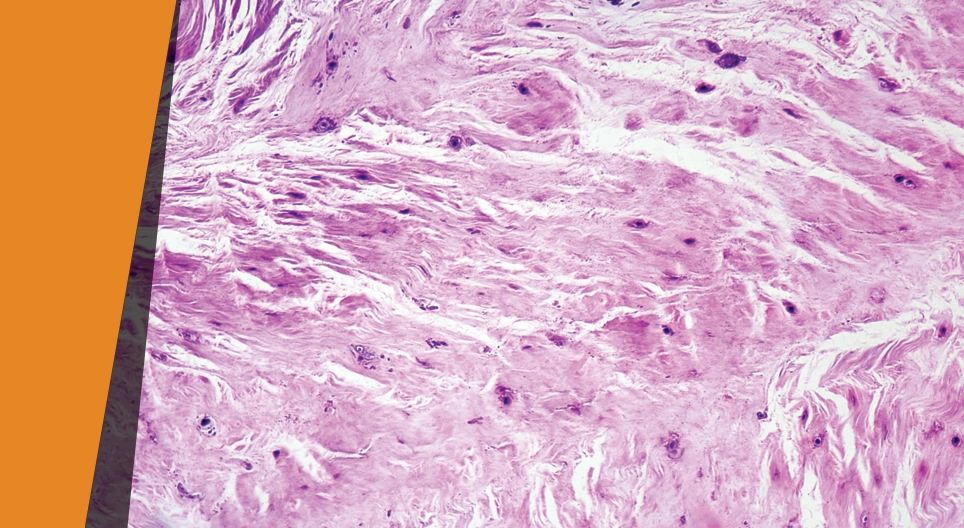 Kontrolowane uderzenie