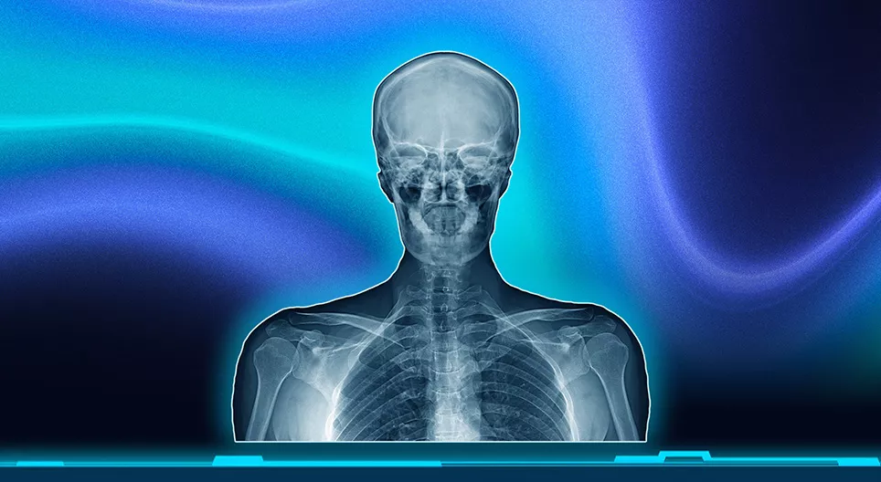 Röntgensugarak