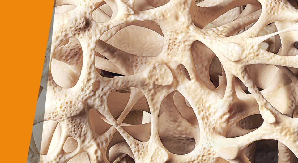 Слабые кости