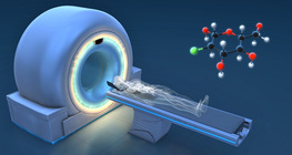 Zasada działania PET-CT
