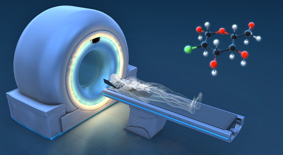 它是如何工作的：PET-CT